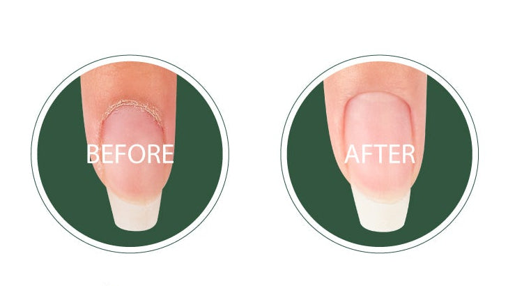 Izemi - Re:cure Cuticle Gel